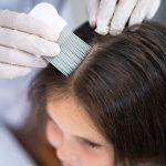 A young girl gets her scalp treated for head lice. A doctor uses a fine tooth comb on her hair.
